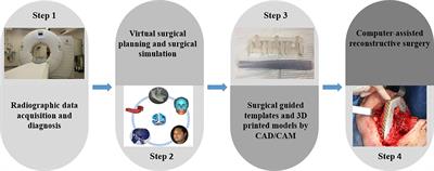 Adherence to Computer-Assisted Surgical Planning in 136 Maxillofacial Reconstructions